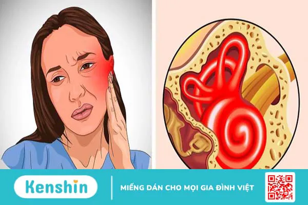 6 triệu chứng cần biết về nhiễm trùng tai và nguyên nhân của nó