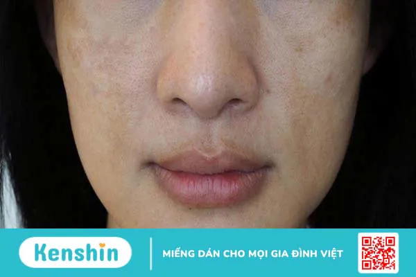 Alpha arbutin dùng sáng hay tối mang lại hiệu quả cao hơn?