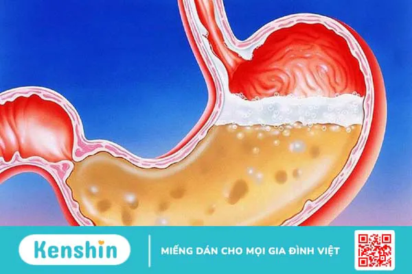 Ăn cơm chan canh có tốt không? Ăn cơm với canh như thế nào cho đúng cách?