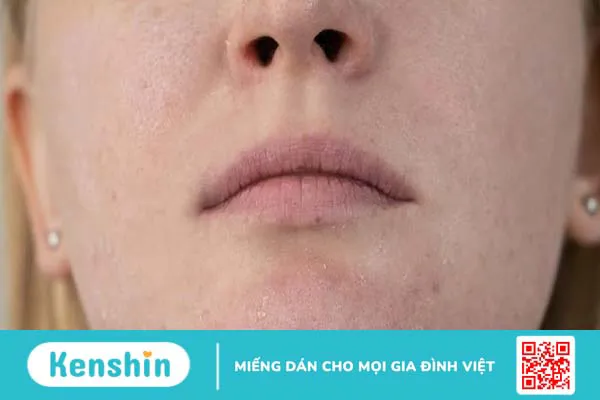 Ăn nhiều muối bị gì? Cách bổ sung lượng muối an toàn cho cơ thể 2