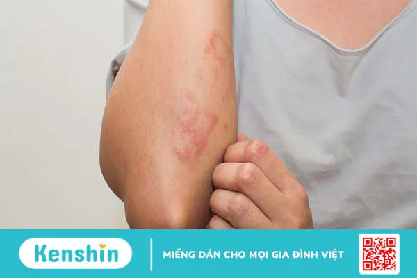 Bà bầu ăn su su được không? Những lợi ích không ngờ từ quả su su