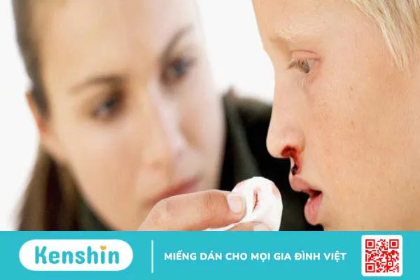 Bà bầu bị chảy máu mũi: Nguyên nhân và cách xử lý tình trạng này