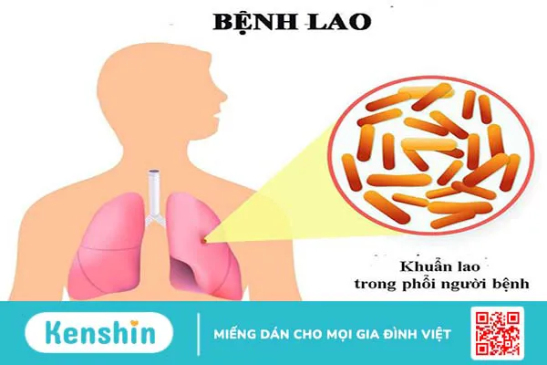 Bạch cầu lympho là gì? Dấu hiệu nhận biết bạch cầu lympho tăng 2