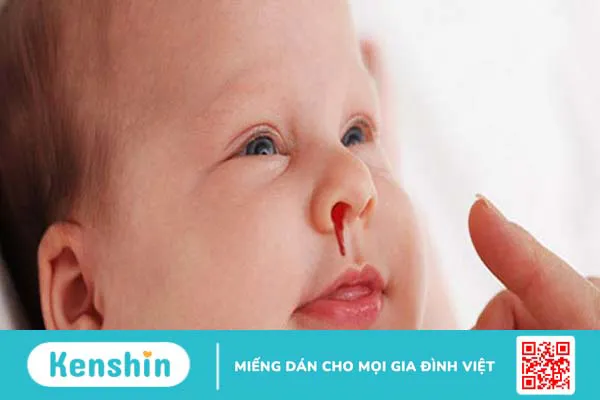 Bạch cầu tăng cao ở trẻ cảnh báo bệnh gì? Chẩn đoán và điều trị bạch cầu tăng cao ở trẻ