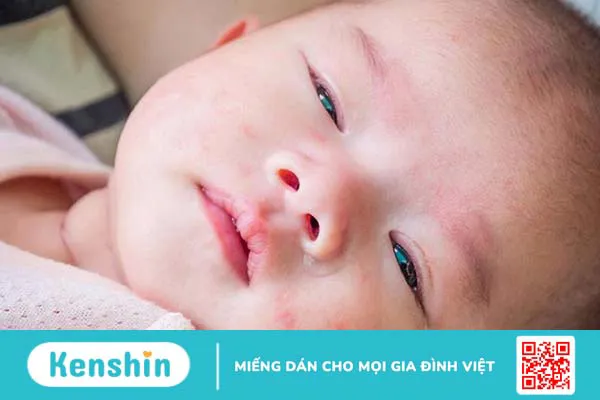 Bạch cầu tăng cao ở trẻ cảnh báo bệnh gì? Chẩn đoán và điều trị bạch cầu tăng cao ở trẻ