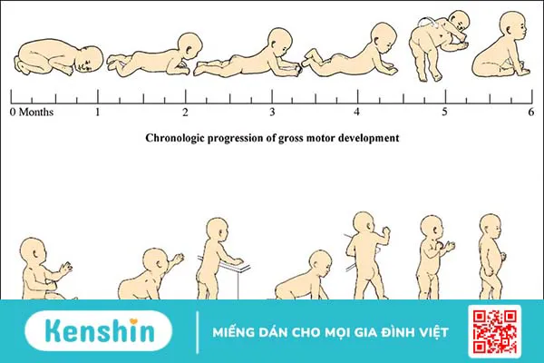 Bại não bẩm sinh: Triệu chứng, yếu tố nguy cơ và cách phòng ngừa 1