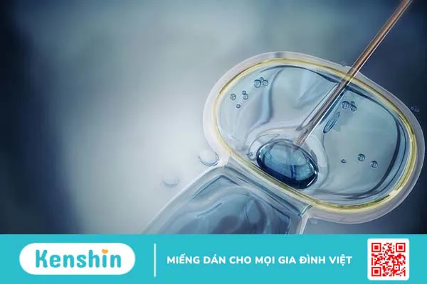 Bại não bẩm sinh: Triệu chứng, yếu tố nguy cơ và cách phòng ngừa 2