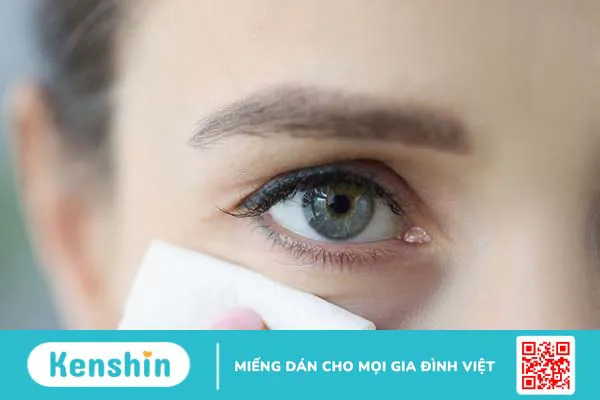 Bạn đã biết cách nhổ lông mi quặm chính xác chưa? 3