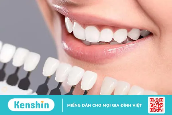 Bảng màu răng sứ nên chọn màu nào đẹp?