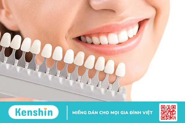 Bảng màu răng sứ nên chọn màu nào đẹp?