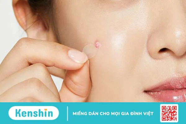 Bật mí điểm nổi bật của miếng dán mụn ban ngày Derma Angel