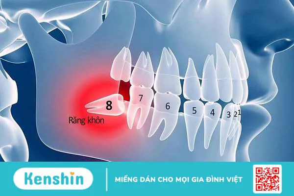 Bật mí một số phương pháp chỉnh răng mọc lệch không cần niềng 1