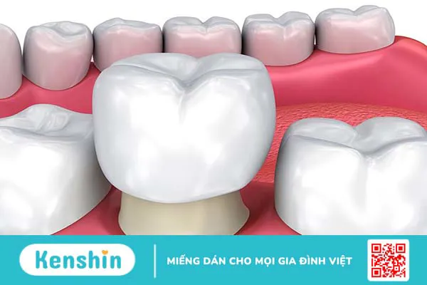 Bật mí một số phương pháp chỉnh răng mọc lệch không cần niềng 3