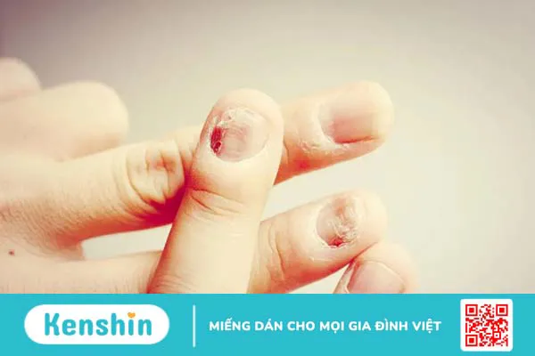 Bật móng tay sau thời gian bao lâu sẽ phục hồi? 3