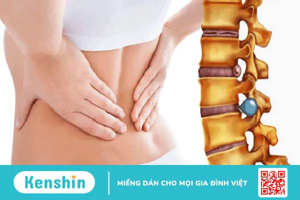 Bắt vít cột sống qua ống nong là thế nào? Quy trình thực hiện kỹ thuật ra sao?