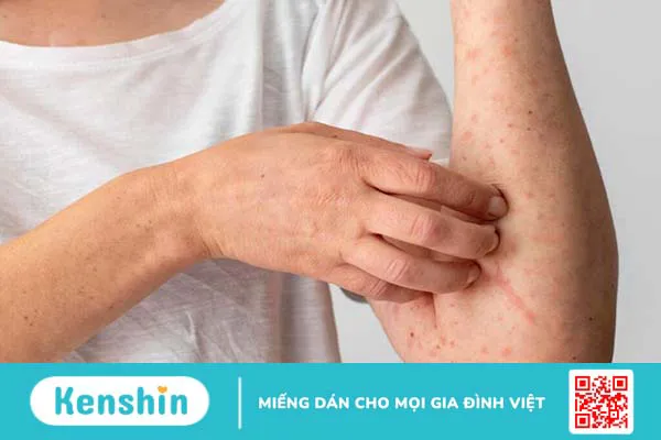 Bầu ăn mướp đắng được không? Ăn như thế nào là thích hợp?