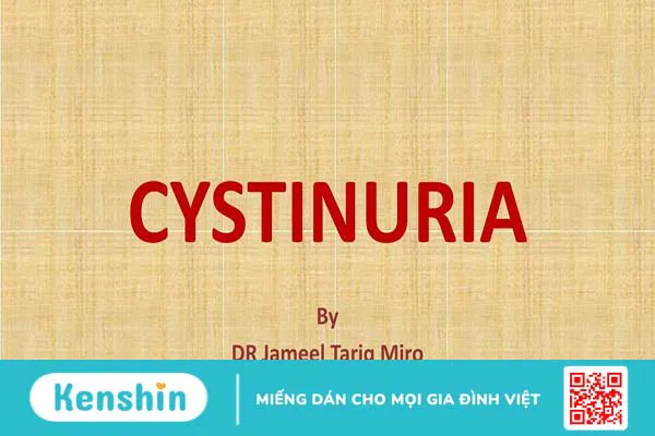 Bệnh cystin niệu: Nguyên nhân, triệu chứng, chẩn đoán và phương pháp điều trị