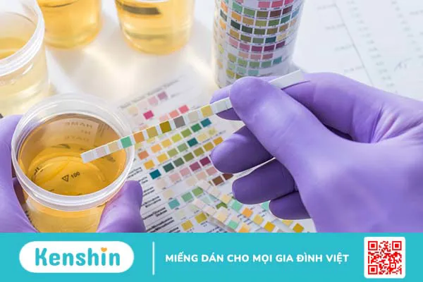 Bệnh cystin niệu: Nguyên nhân, triệu chứng, chẩn đoán và phương pháp điều trị