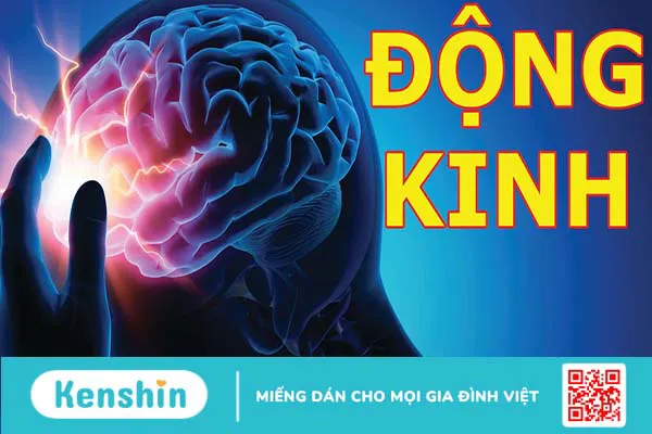 Bệnh động kinh có chữa được không? Tác động của bệnh động kinh đối với sức khỏe