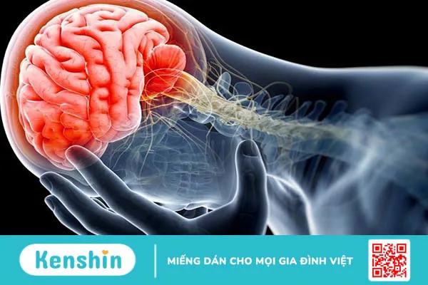 Bệnh động kinh có chữa được không? Tác động của bệnh động kinh đối với sức khỏe