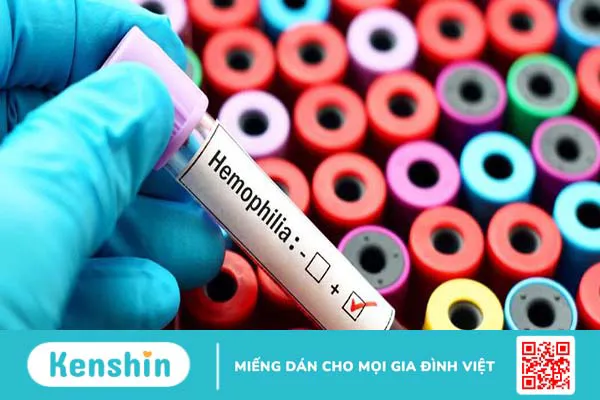 Bệnh Hemophilia (máu khó đông) có nguy hiểm không?