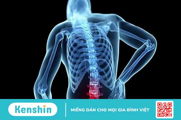 Bệnh lao cột sống có lây từ người này sang người khác không?