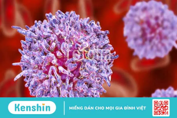 Bệnh Leukemia là gì? Cách chẩn đoán và điều trị bệnh Leukemia thế nào?