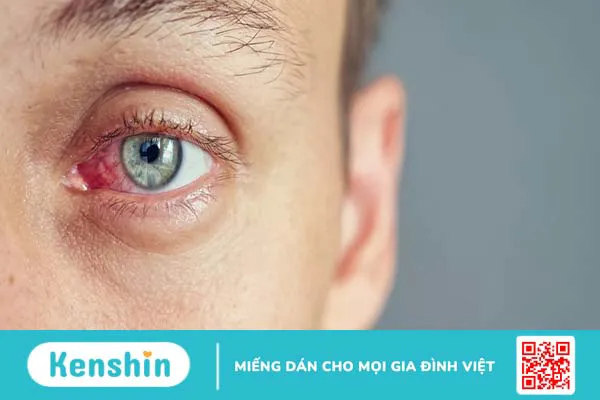 Bệnh lý đáy mắt và những thông tin bạn không nên bỏ qua