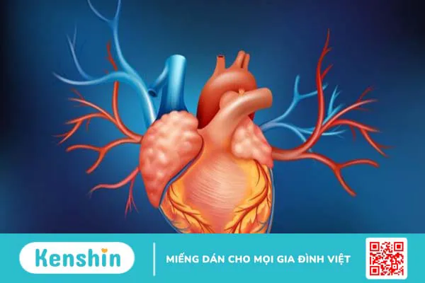 Bệnh mạch vành 3 nhánh là gì? Phương pháp chẩn đoán và điều trị bệnh mạch vành 3 nhánh