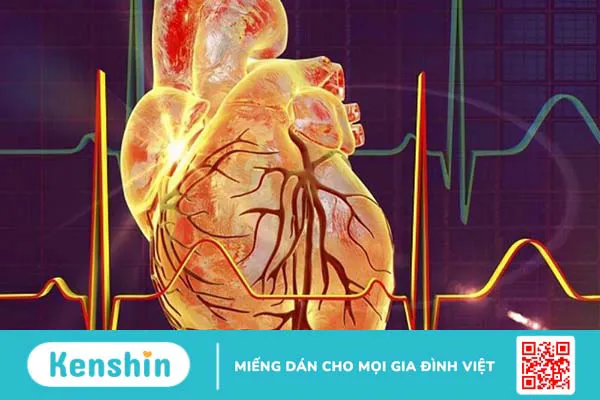 Bệnh mạch vành 3 nhánh là gì? Phương pháp chẩn đoán và điều trị bệnh mạch vành 3 nhánh