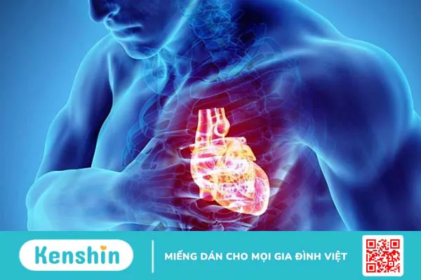 Bệnh mạch vành 3 nhánh là gì? Phương pháp chẩn đoán và điều trị bệnh mạch vành 3 nhánh