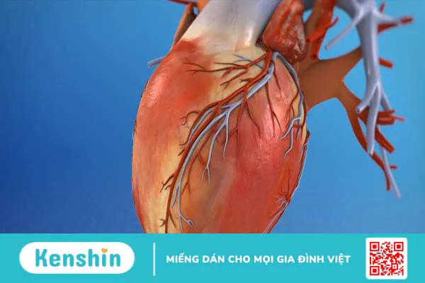 Bệnh nhân tim mạch cần chuẩn bị gì trước khi chụp CT? Những lưu ý cần biết