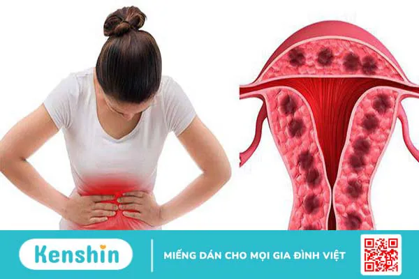 Bệnh sốt xuất huyết có ảnh hưởng đến kinh nguyệt không?