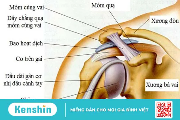 Bệnh viêm gân chóp xoay vai và phương pháp điều trị hiệu quả nhất hiện nay 1