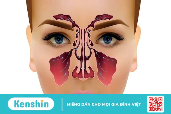 Bệnh viêm mũi không dị ứng là gì? Có nguy hiểm không? 1