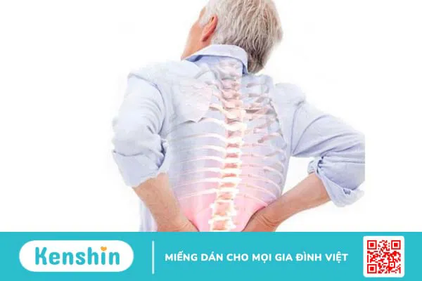 Bị gai cột sống có nên nằm nệm không? Cách chọn mua nệm hỗ trợ tốt cho lưng