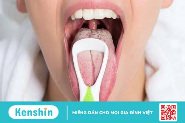 Bị loét ở lưỡi không thấy đau có phải dấu hiệu ung thư lưỡi?