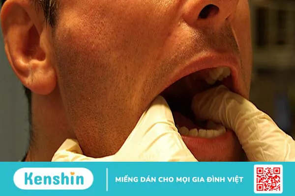 Bị viêm khớp thái dương hàm khám ở đâu?