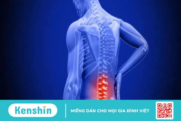 Bị vôi hóa cột sống nên ăn gì? Top 5 loại thực phẩm tốt cho người bệnh vôi hoá cột sống 1