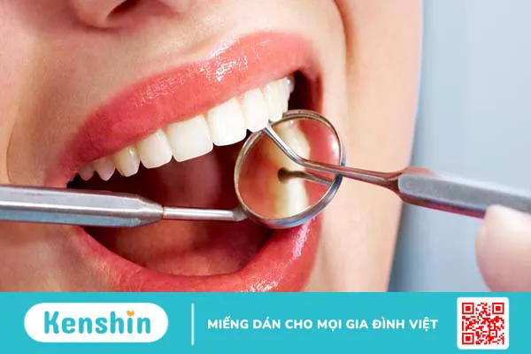 Biến chứng viêm lợi trùm do răng khôn là gì? Có nguy hiểm không?