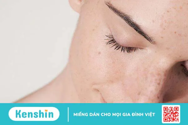 Bioderma xanh dùng cho da gì? Review sản phẩm