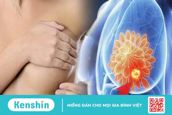 BIRADS 3 và những bạn không nên bỏ qua về BIRADS 3