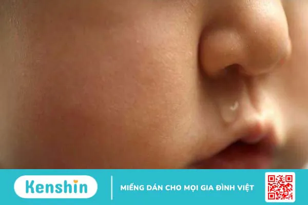 Bố mẹ cần làm gì khi trẻ sơ sinh bị nghẹt mũi, khò khè?