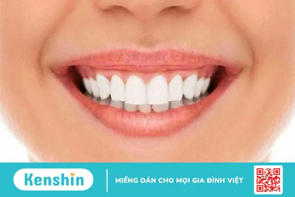 Bọc răng sứ không mài răng có được không? Ai nên làm phương pháp này?