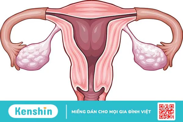 Buồng trứng: Cấu tạo, chức năng và các bệnh lý phổ biến liên quan đến buồng trứng