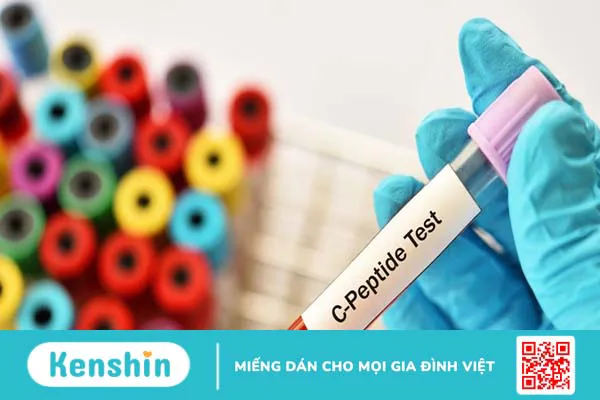 C-peptide là gì? Ý nghĩa kết quả của xét nghiệm C-peptide