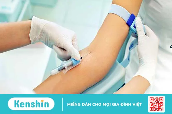 C-peptide là gì? Ý nghĩa kết quả của xét nghiệm C-peptide