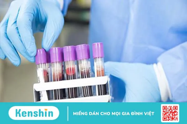 CA 72.4 là gì? Xét nghiệm CA 72.4 có ý nghĩa gì?