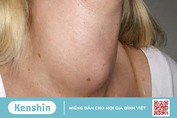 Các bệnh nội tiết thường gặp và cách điều trị dứt điểm 2