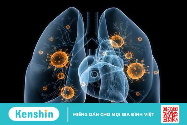 Các bệnh phổ biến gây ra nhiễm trùng cơ hội  3